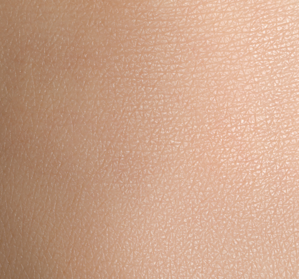 Is Skin Texture Normal