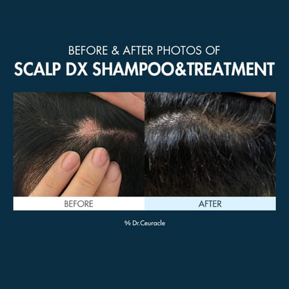 DR CEURACLE Scalp DX Scaling Shampoo 550ml