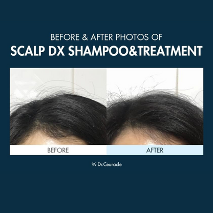 DR CEURACLE Scalp DX Scaling Shampoo 550ml