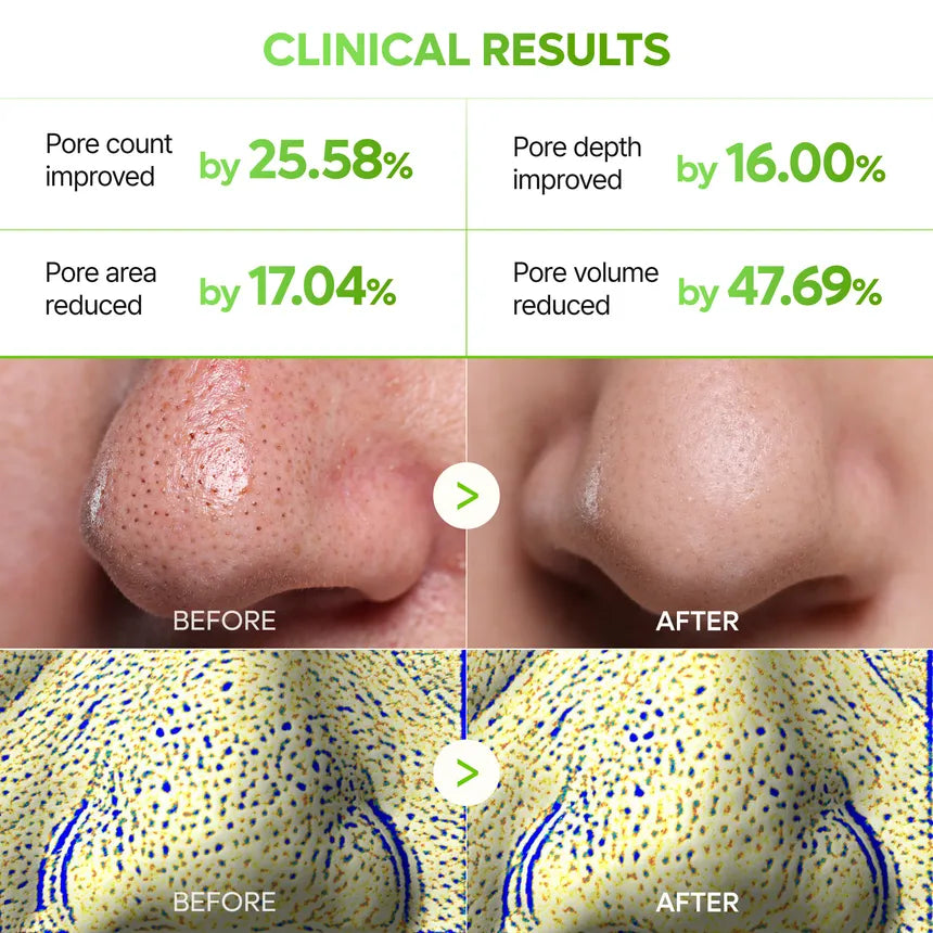 DR MELAXIN - CACTOX 3-STEP NOSE PORE PACK